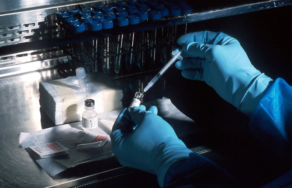 Cistoscopia-masculina