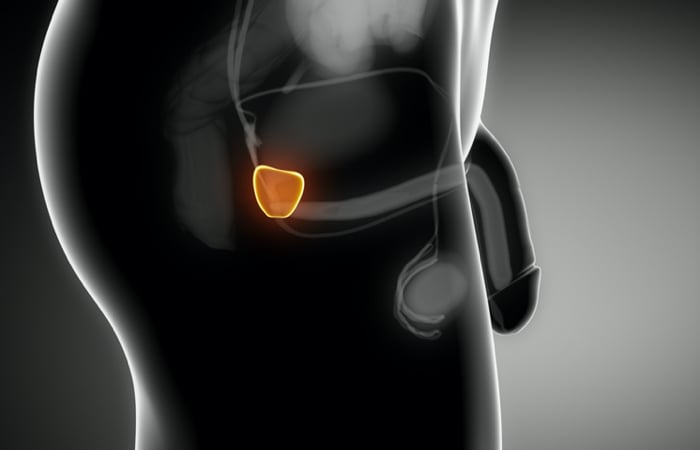 disfuncao-eretil-pos-prostatectomia