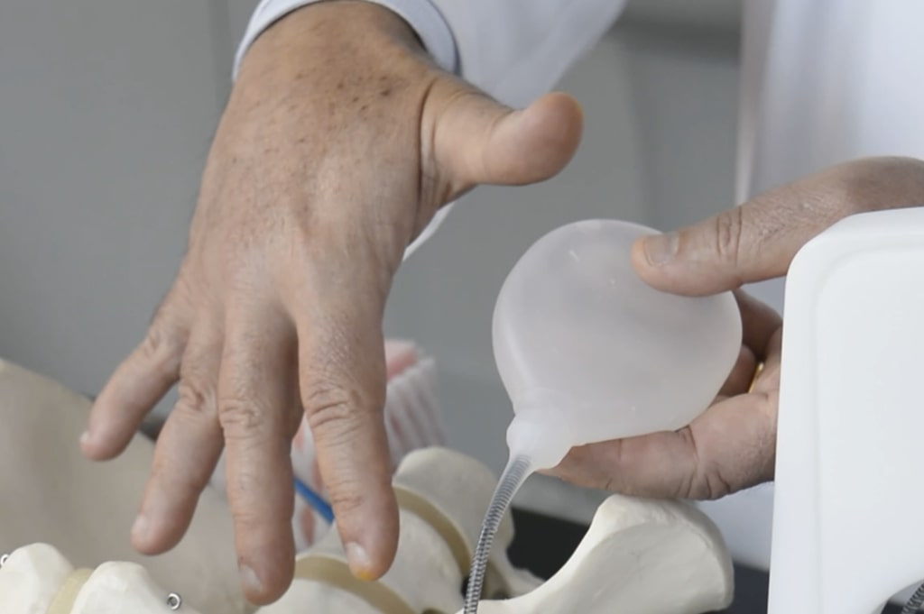 dr paulo egydio mostrando reservatório da prótese peniana inflável 