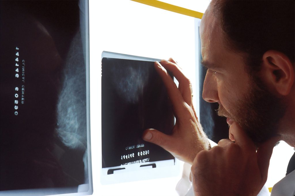 Médico observando o resultado de um exame sobre superfície iluminada representando o diagnóstico e tratamento para câncer de próstata em idosos