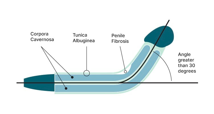large TRAD 01 INGLES