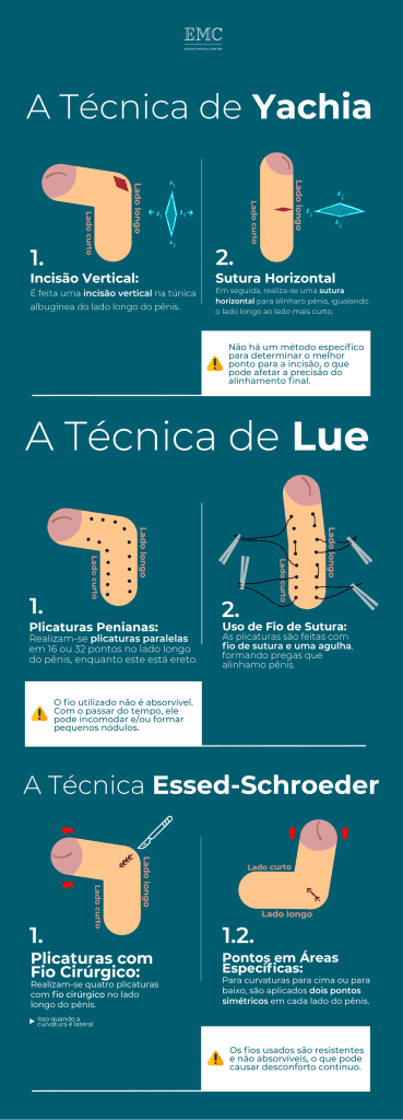 infográfico mostrando passo a passo das técnicas de pregas Yachia, Lue e Essed-Schroeder