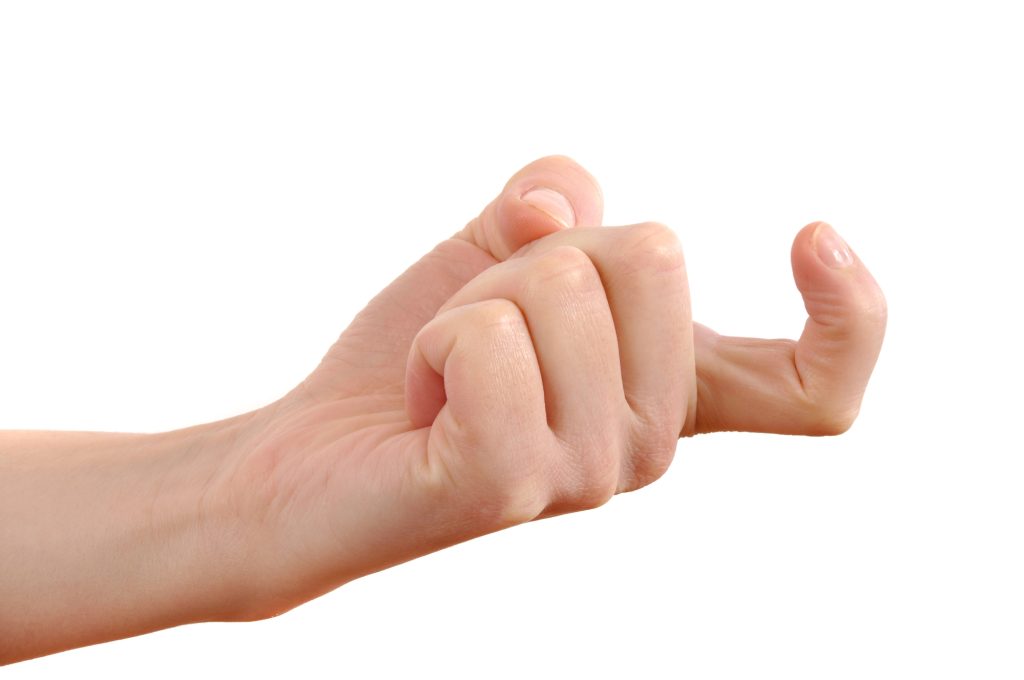 Fundo branco, braço parcial, e mão à esquerda semi fechada com dedo indicador torto fazendo sinal, representando a Técnica de Devine-Horton que trata o pênis curvo