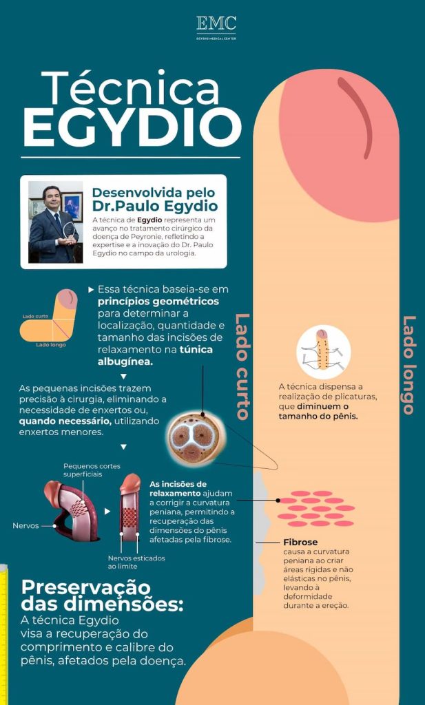 infográfico detalhando a origem da técnica egydio para correção da curvatura peniana