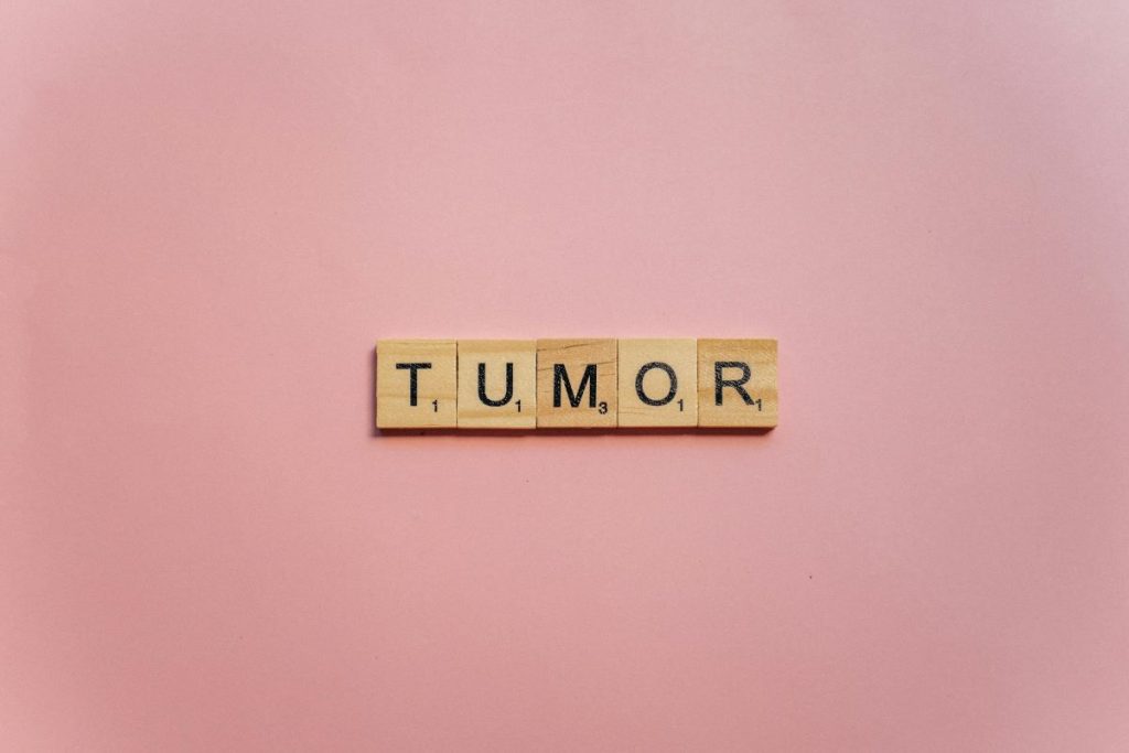 Las letras de la palabra tumor en bloques de madera sobre un fondo rosa claro.
