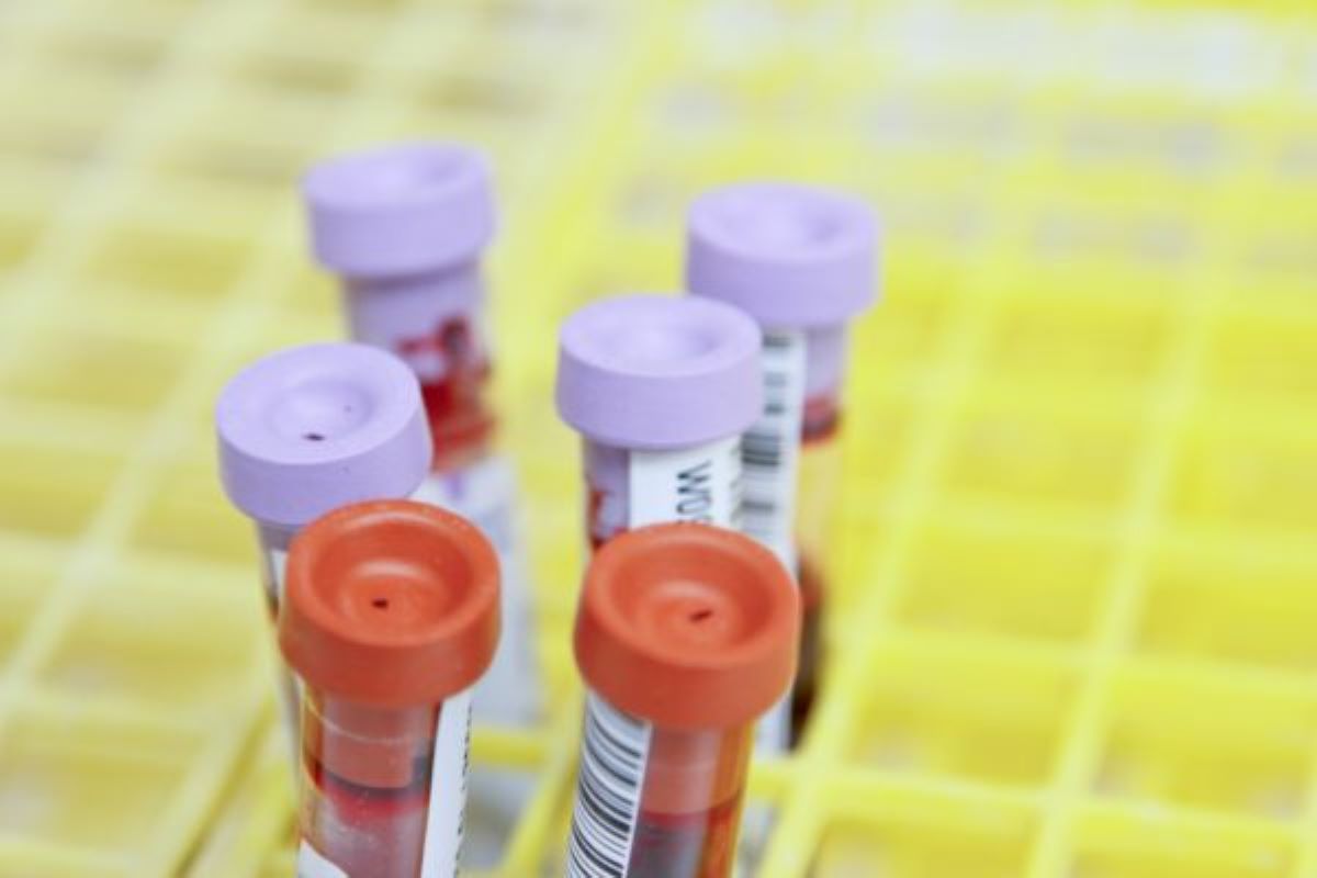 Test tubes with blood samples