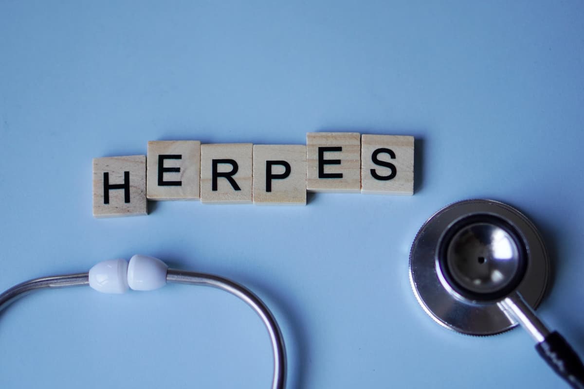 palavra "HERPES" está formada por blocos de madeira com letras pretas e estetoscópio prateado, posicionados sobre um fundo azul claro, simbolizando herpes genital