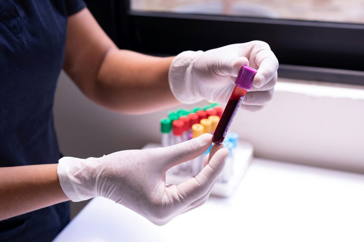A healthcare professional, apparently female, whose face is not shown. She wears white gloves and holds a tube with a blood sample. To the left is a tray with empty tubes topped in green, yellow, and red.