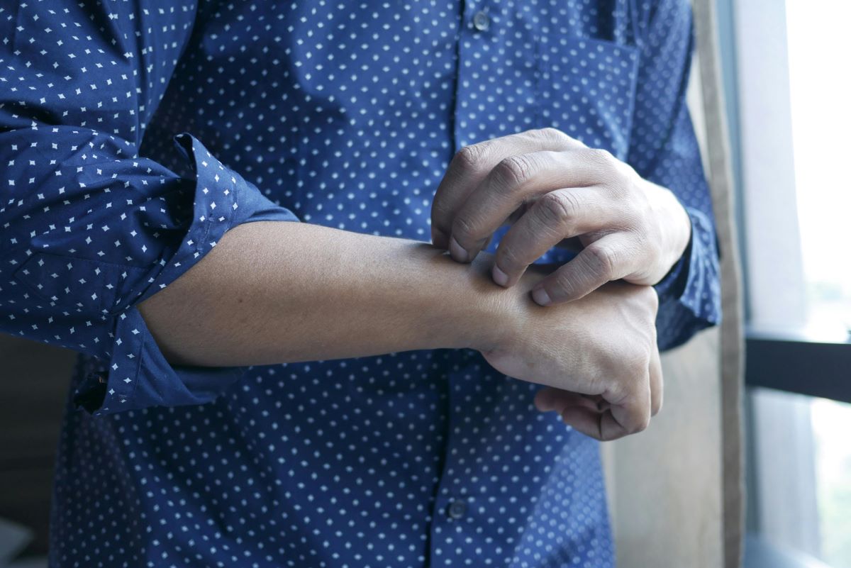 A white man wearing a navy-blue shirt with small white dots. The sleeves are rolled up nearly to his elbows. One hand is clenched, and he is scratching it with the other hand.