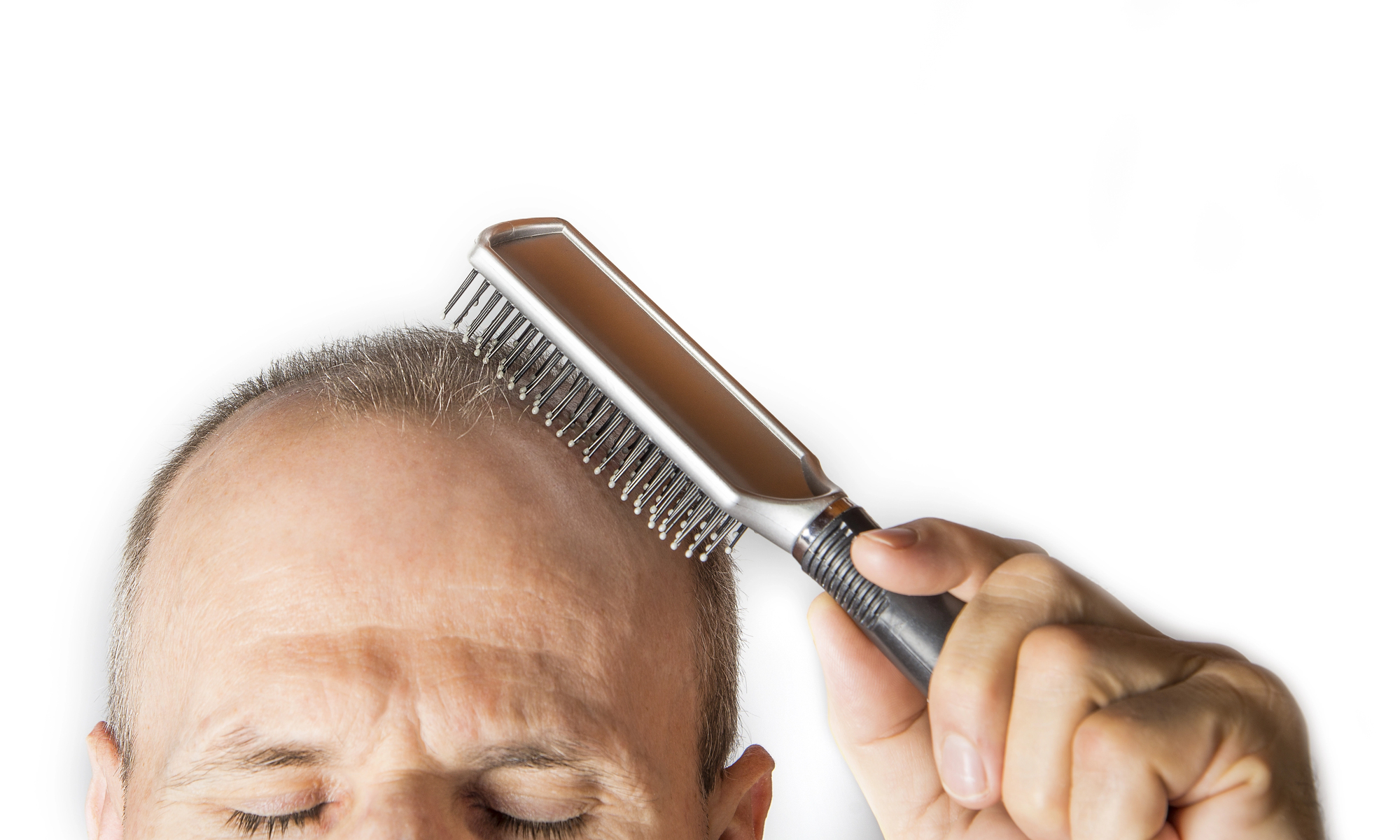 Fundo branco e parte da cabeça de um homem branco calvo segurando uma escova de cabelo com a mão sobre a cabeça durante tratamento para disfunção erétil e calvície