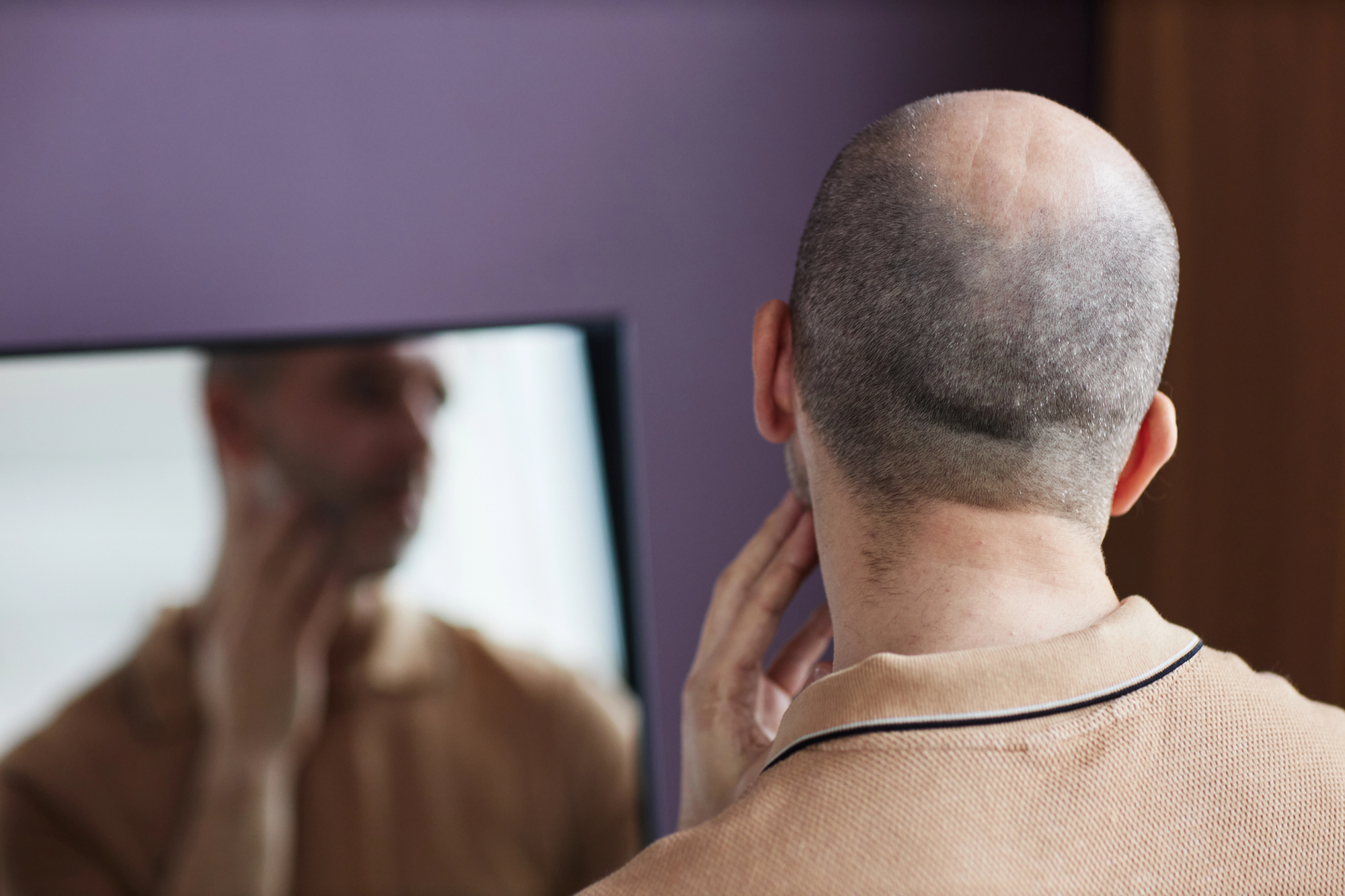 White man with a shaved head, wearing a brown polo shirt and touching his chin while looking at himself in a mirror against a purple wall, reflecting on erectile dysfunction and hair loss White man with a shaved head, wearing a brown polo shirt and touching his chin while looking at himself in a mirror against a purple wall, reflecting on erectile dysfunction and hair loss