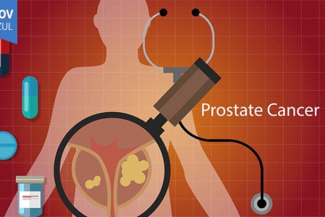 cancer-de-prostata-e-protese-peniana